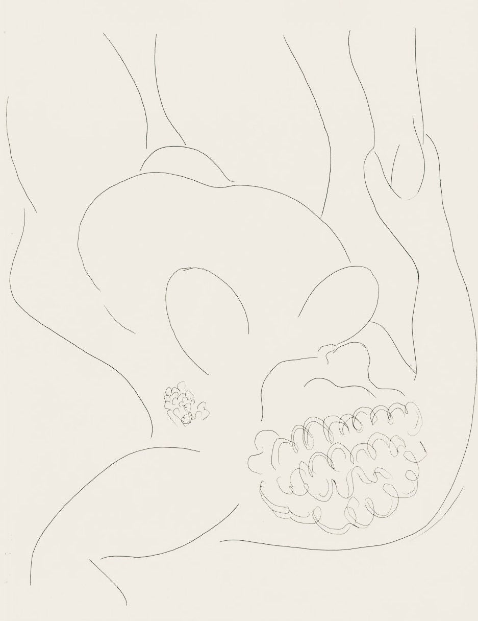 Henri Matisse, Une négresse par le démon..., Poésies, Limited Edition Lithograph