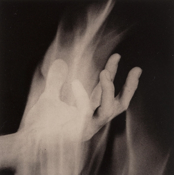 Robert Mapplethorpe, Hand in Fire, A Season in Hell, Limited Edition Photogravure