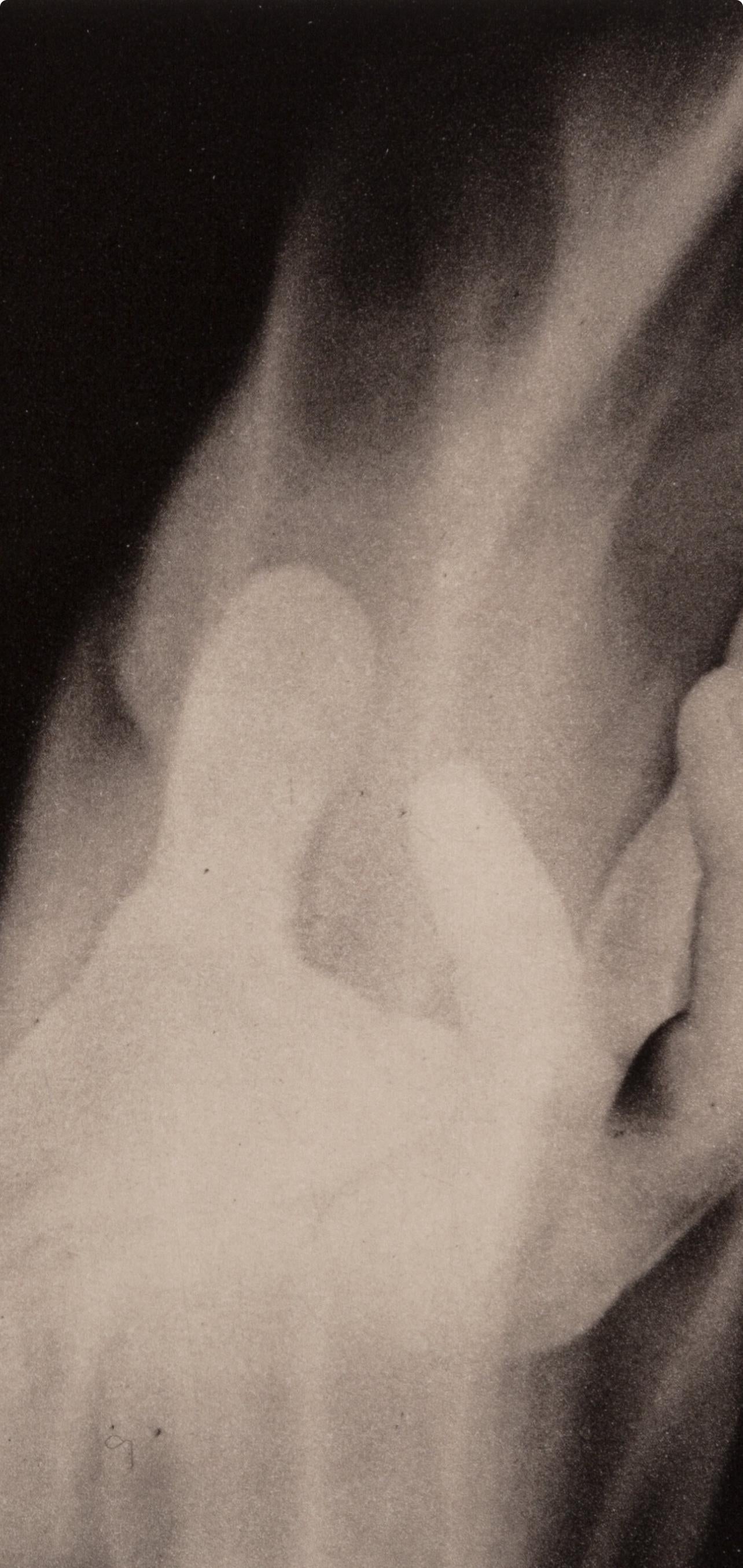 Robert Mapplethorpe, Hand in Fire, A Season in Hell, Limited Edition Photogravure